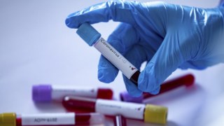 Кількість підтверджених випадків захворювання на коронавірус на Львівщині за добу зросла на 24 – до 454